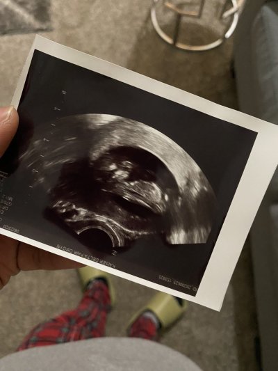 Watch Bakary! for BIOR FLOWERS's leaked NSFW photo on TwXstars