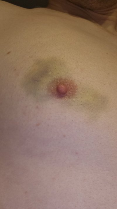 Watch 🛸Ｃｏｓｍｉｃ Ｂｒｏｃｃｏｌｉ🥦 ℕ𝕠𝕨 𝕠𝕟𝕝𝕪 $𝟞.𝟞𝟡's leaked NSFW photo on TwXstars