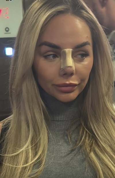 Watch ✖️EMILIE-RAE✖️'s leaked NSFW photo on TwXstars